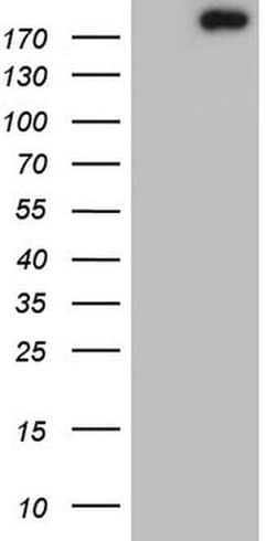 TOP2A Monoclonal Antibody (OTI19D4), TrueMAB , OriGene:Antibodies:Primary
