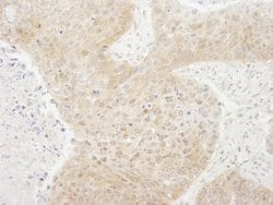 TORC1 Polyclonal Antibody, Bethyl Laboratories 10 &mu;L; Unconjugated:Antibodies,