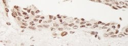 TORC2 Rabbit anti-Human, Polyclonal, Bethyl Laboratories 100 &mu;l; Unlabeled:Antibodies,