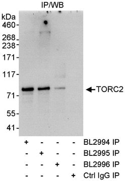 TORC2 Rabbit anti-Human, Polyclonal, Bethyl Laboratories 100 &mu;l; Unlabeled:Antibodies,