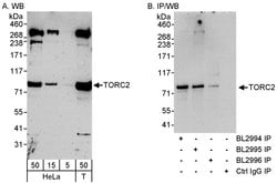TORC2 Rabbit anti-Human, Polyclonal, Bethyl Laboratories 100 &mu;L; Unconjugated:Antibodies,