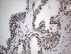 TP53BP1 Monoclonal Antibody (OTI2G3), TrueMAB , OriGene 100 &mu;L; Unconjugated:Antibodies,