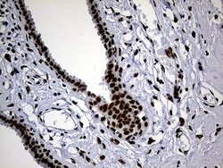 TP53BP1 Monoclonal Antibody (OTI6D9), TrueMAB , OriGene 100 &mu;L; Unconjugated:Antibodies,