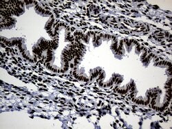 TP53BP1 Monoclonal Antibody (OTI6D9), TrueMAB , OriGene:Antibodies:Primary