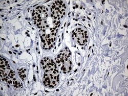 TP53BP1 Monoclonal Antibody (OTI6D9), TrueMAB , OriGene 100 &mu;L; Unconjugated:Antibodies,
