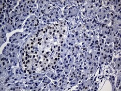 TP53BP1 Monoclonal Antibody (OTI5H4), TrueMAB , OriGene:Antibodies:Primary
