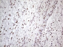 TP53BP1 Monoclonal Antibody (OTI5E1), TrueMAB , OriGene 100 &mu;L; Unconjugated:Antibodies,