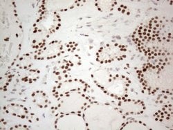 TP53BP1 Monoclonal Antibody (OTI5E1), TrueMAB , OriGene 100 &mu;L; Unconjugated:Antibodies,