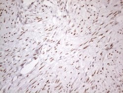 TP53BP1 Monoclonal Antibody (OTI5E1), TrueMAB , OriGene 100 &mu;L; Unconjugated:Antibodies,