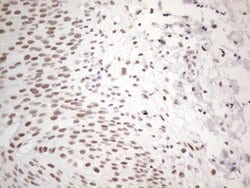 TP53BP1 Monoclonal Antibody (OTI5E1), TrueMAB , OriGene 100 &mu;L; Unconjugated:Antibodies,