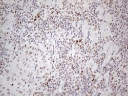 TP53BP1 Monoclonal Antibody (OTI5E1), TrueMAB , OriGene 100 &mu;L; Unconjugated:Antibodies,