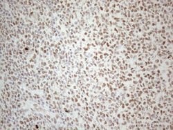 TP53BP1 Monoclonal Antibody (OTI5E1), TrueMAB , OriGene 100 &mu;L; Unconjugated:Antibodies,