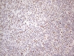 TP53BP1 Monoclonal Antibody (OTI5E1), TrueMAB , OriGene:Antibodies:Primary