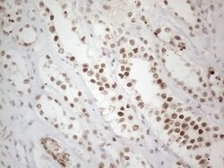 TP53BP1 Monoclonal Antibody (OTI5E1), TrueMAB , OriGene 100 &mu;L; Unconjugated:Antibodies,