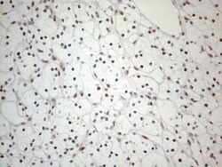 TP53BP1 Monoclonal Antibody (OTI5E1), TrueMAB , OriGene 100 &mu;L; Unconjugated:Antibodies,