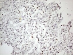 TP53BP1 Monoclonal Antibody (OTI5E1), TrueMAB , OriGene:Antibodies:Primary