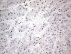 TP53BP1 Monoclonal Antibody (OTI5E1), TrueMAB , OriGene 100 &mu;L; Unconjugated:Antibodies,