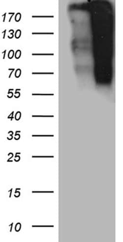 TP53BP1 Monoclonal Antibody (OTI2G3), TrueMAB , OriGene 100 &mu;L; Unconjugated:Antibodies,