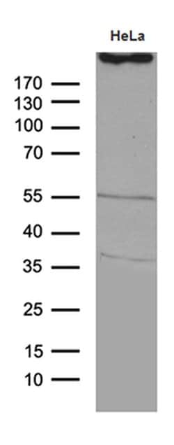 TP53BP1 Monoclonal Antibody (OTI2G3), TrueMAB , OriGene 100 &mu;L; Unconjugated:Antibodies,