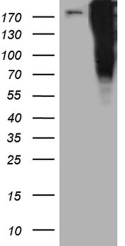 TP53BP1 Monoclonal Antibody (OTI6D9), TrueMAB , OriGene 100 &mu;L; Unconjugated:Antibodies,