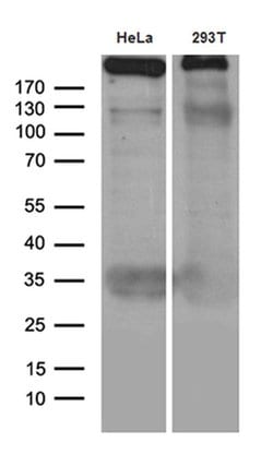TP53BP1 Monoclonal Antibody (OTI6D9), TrueMAB , OriGene:Antibodies:Primary