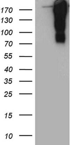 TP53BP1 Mouse anti-Human, Clone: OTI5H4, lyophilized, TrueMAB 100 &mu;g;
