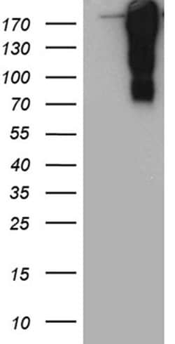 TP53BP1 Monoclonal Antibody (OTI5H4), TrueMAB , OriGene 100 &mu;L; Unconjugated:Antibodies,