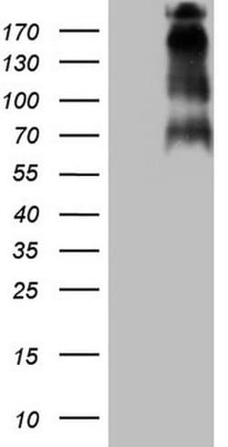 TP53BP1 Monoclonal Antibody (OTI5E1), TrueMAB , OriGene 100 &mu;L; Unconjugated:Antibodies,