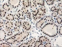 TP53I3 Mouse anti-Human, Clone: OTI3B11, liquid, TrueMAB 100 &mu;L; Unconjugated:Antibodies,