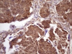 TP53RK Monoclonal Antibody (OTI4D10), TrueMAB , OriGene 100 &mu;L; Unconjugated:Antibodies,