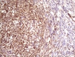 TP53RK Mouse anti-Human, Clone: OTI5A5, lyophilized, TrueMAB 100 &mu;g;