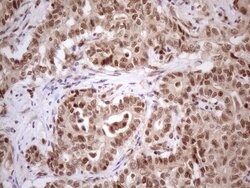 TP53RK Mouse anti-Human, Clone: OTI5A5, lyophilized, TrueMAB 100 &mu;g;