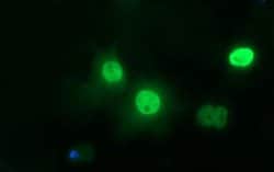 TP73 Monoclonal Antibody (OTI1B5), TrueMAB , OriGene:Antibodies:Primary