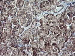 TP73 Mouse anti-Human, Clone: OTI2H2, lyophilized, TrueMAB 100 &mu;g; Unconjugated:Antibodies,