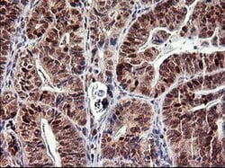 TP73 Monoclonal Antibody (OTI2H2), TrueMAB , OriGene 100 &mu;L; Unconjugated:Antibodies,