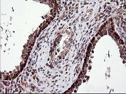 TP73 Mouse anti-Human, Clone: OTI2H2, lyophilized, TrueMAB 100 &mu;g; Unconjugated:Antibodies,