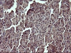 TP73 Mouse anti-Human, Clone: OTI1B5, lyophilized, TrueMAB 100 &mu;g; Unconjugated:Antibodies,