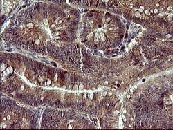 TP73 Mouse anti-Human, Clone: OTI1B5, lyophilized, TrueMAB 100 &mu;g; Unconjugated:Antibodies,