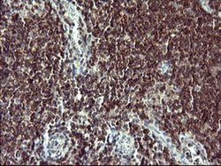 TP73 Monoclonal Antibody (OTI1B5), TrueMAB , OriGene:Antibodies:Primary