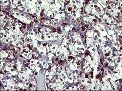 TP73 Monoclonal Antibody (OTI3C5), TrueMAB , OriGene:Antibodies:Primary