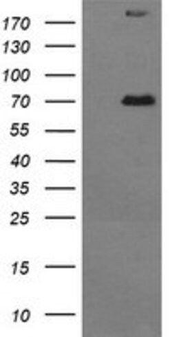 TP73 Mouse anti-Human, Clone: OTI2H2, lyophilized, TrueMAB 100 &mu;g; Unconjugated:Antibodies,