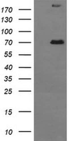 TP73 Monoclonal Antibody (OTI2H2), TrueMAB , OriGene 100 &mu;L; Unconjugated:Antibodies,