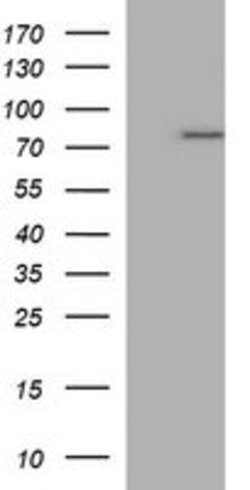 TP73 Mouse anti-Human, Clone: OTI1B5, lyophilized, TrueMAB 100 &mu;g; Unconjugated:Antibodies,