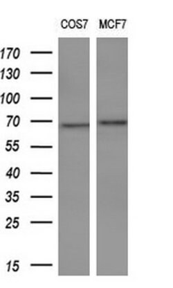 TP73 Mouse anti-Human, Clone: OTI1B5, lyophilized, TrueMAB 100 &mu;g; Unconjugated:Antibodies,