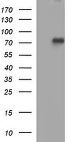 TP73 Monoclonal Antibody (OTI3C5), TrueMAB , OriGene 100 &mu;L; Unconjugated:Antibodies,