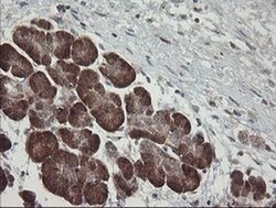 TPD52L3 Monoclonal Antibody (OTI4C12), TrueMAB , OriGene 100 &mu;L; Unconjugated:Antibodies,