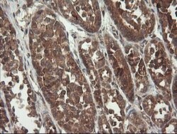 TPD52L3 Monoclonal Antibody (OTI4C12), TrueMAB , OriGene:Antibodies:Primary