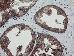 TPD52L3 Monoclonal Antibody (OTI4C12), TrueMAB , OriGene 100 &mu;L; Unconjugated:Antibodies,
