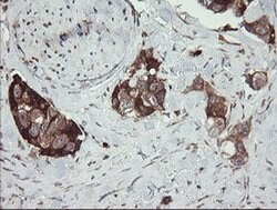 TPD52L3 Monoclonal Antibody (OTI4C12), TrueMAB , OriGene:Antibodies:Primary