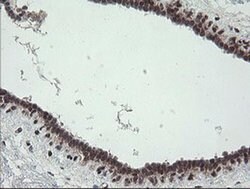 TPD52L3 Monoclonal Antibody (OTI3D11), TrueMAB , OriGene 30 &mu;L | Buy Online | Origene Technologies | Fisher Scientific